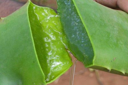 aloe